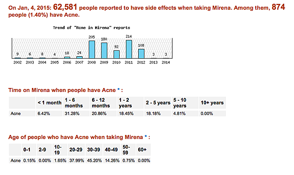 Mirena casue acne 1