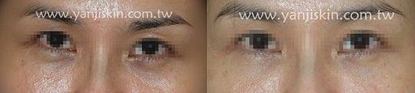 案例二結構型.jpg 案例二結構型.jpg