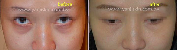 螢幕快照 2015-05-30 下午7.09.48 螢幕快照 2015-05-30 下午7.09.48