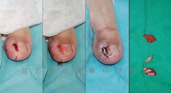 nail plasty nail plasty