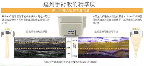 極線音波拉皮4