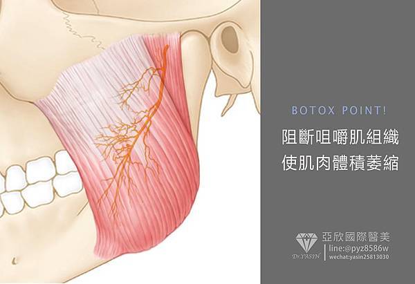 肉毒示意.jpg