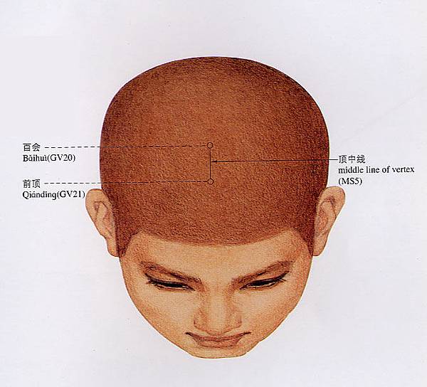 15-頭針穴線圖（頂區）