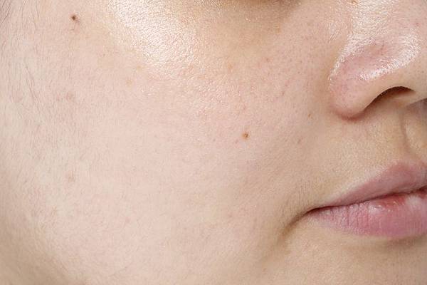 碧麗妃濾鏡平衡美肌水因為含有特殊的植萃美容成分能促進角質健康。碧麗妃,濾鏡平衡美肌水,評價,出油,毛孔粗大,濕敷,回購率,平衡,調理膚況,植物萃取,精華,真材實料,推薦