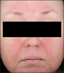 miravaso.jpg miravaso.jpg