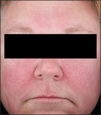 Patient5_8076-005_0000_baseline.jpg Patient5_8076-005_0000_baseline.jpg