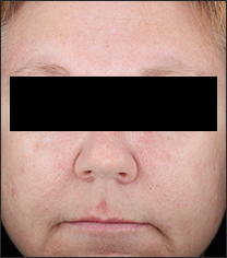 Patient5_8076-005_0002_3%20hours.jpg Patient5_8076-005_0002_3%20hours.jpg