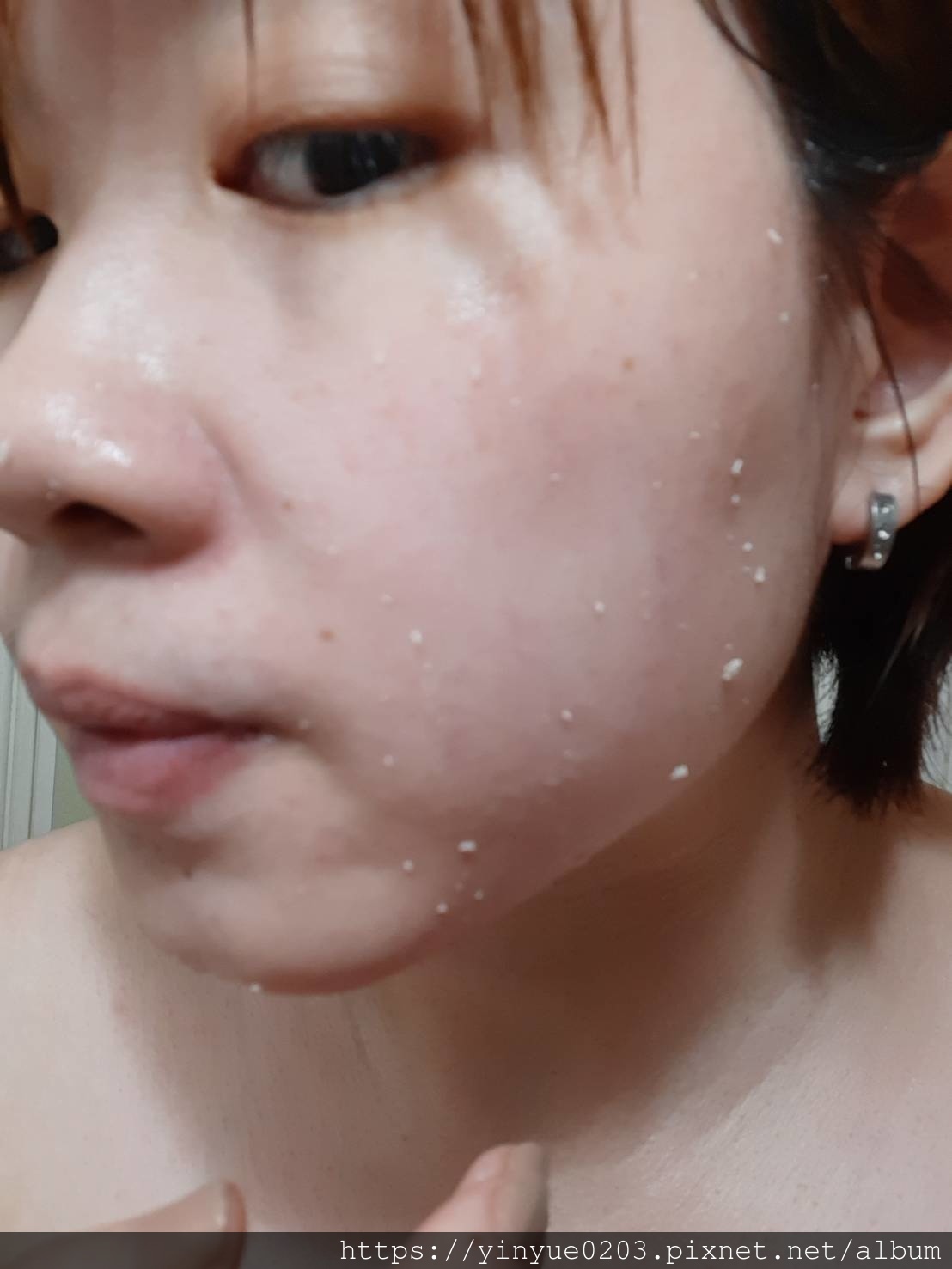 512374 去角質的死皮
