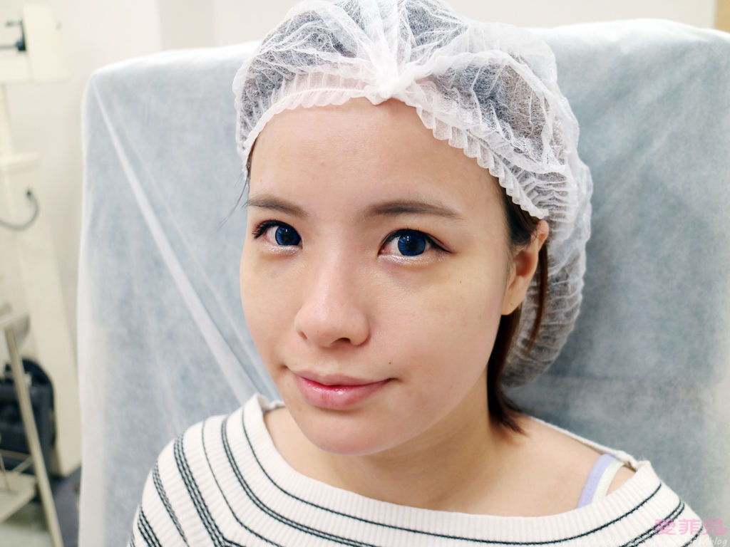 豐唇/美麗爾 豐唇/美麗爾