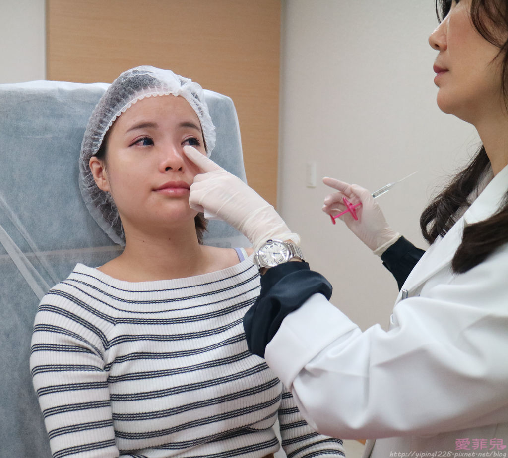 豐唇/美麗爾 豐唇/美麗爾