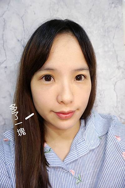 皮醫師診所/臉部埋線拉提/魔幻極光