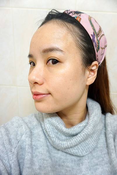 尚緹診所/M22彩衝光/肉毒桿菌/改善暗沉/小臉/雷射