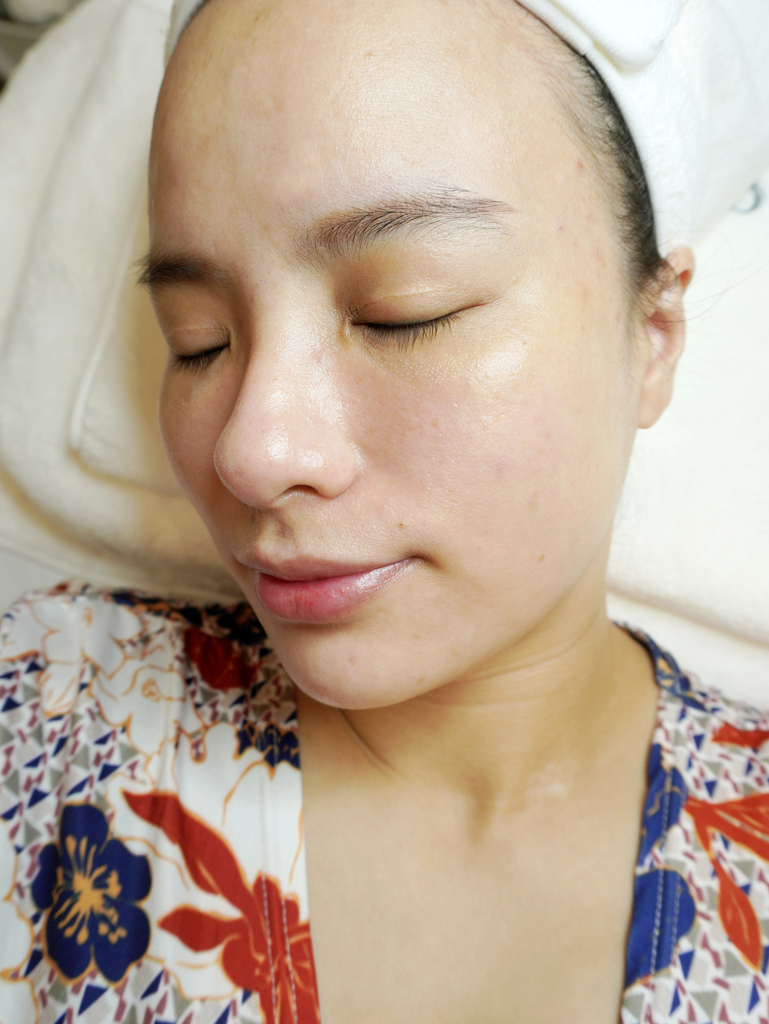 新北男女做脸粉刺清理推荐SESAME，不只粉刺、脂肪球也一并清光