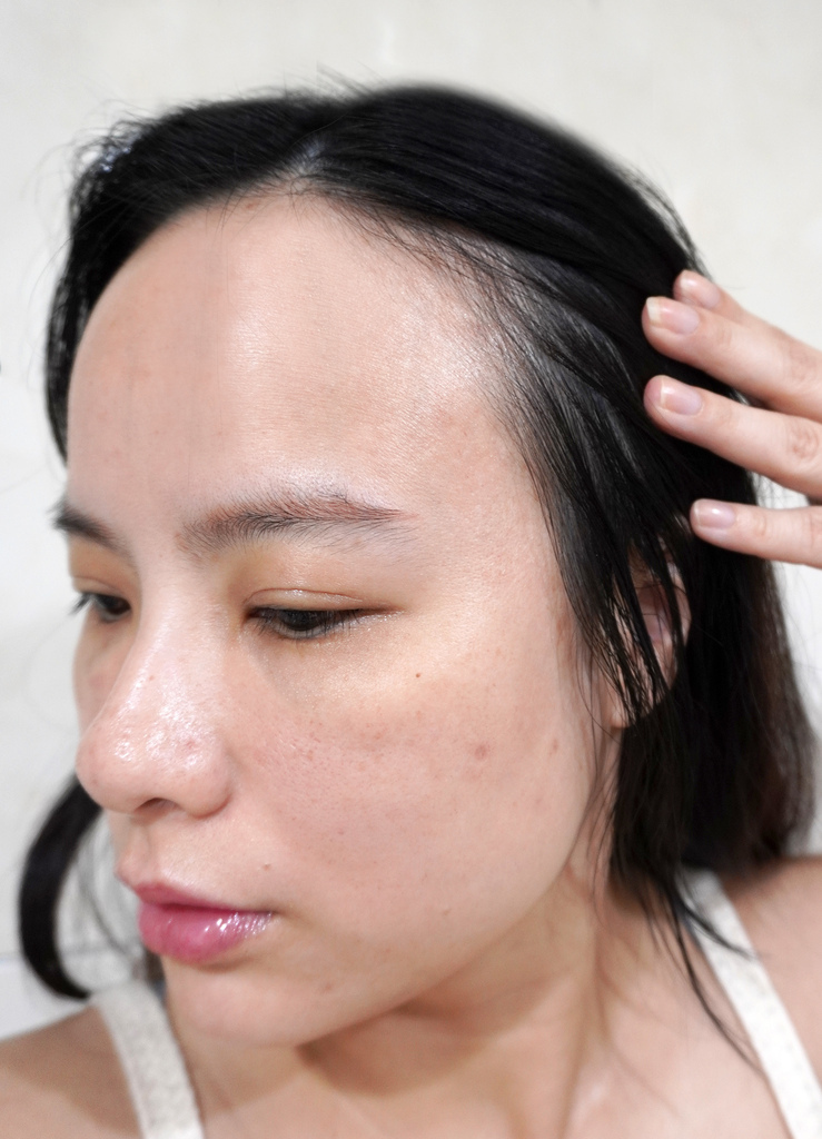 Belléesse 研知诊所/蜂巢皮秒雷射