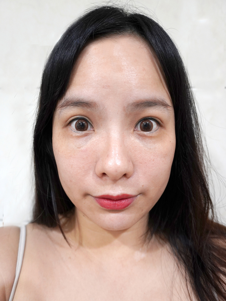 Belléesse 研知诊所/蜂巢皮秒雷射