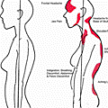 poor-posture-affecting-women-278x206 (1).gif