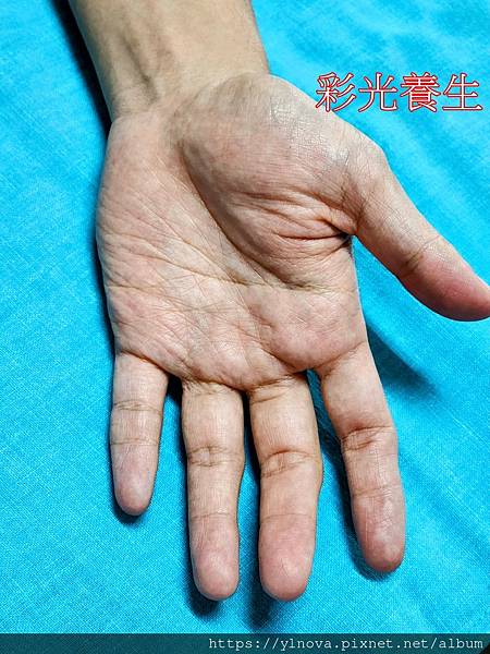 吃口香糖後遺症手相