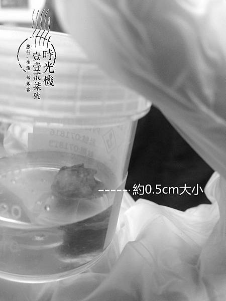 告別甲狀腺腫瘤 (32).JPG