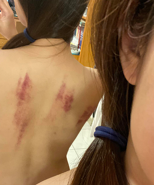 經驗 第一次運動按摩 收費30分鐘500元我已哀哀叫到不行 靠腰痛背黑青 黃小腹雜記 痞客邦