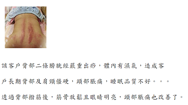 經驗 第一次運動按摩 收費30分鐘500元我已哀哀叫到不行 靠腰痛背黑青 黃小腹雜記 痞客邦