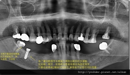 何_惠珍_20170818_1