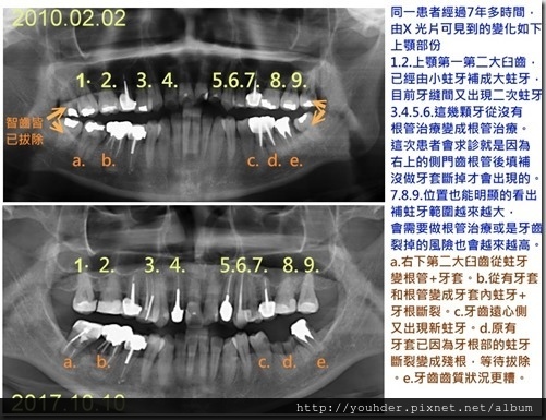 未命名 - 案例2--X 光的變化