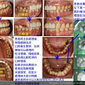 患者牙齒部分處理前後對照.jpg