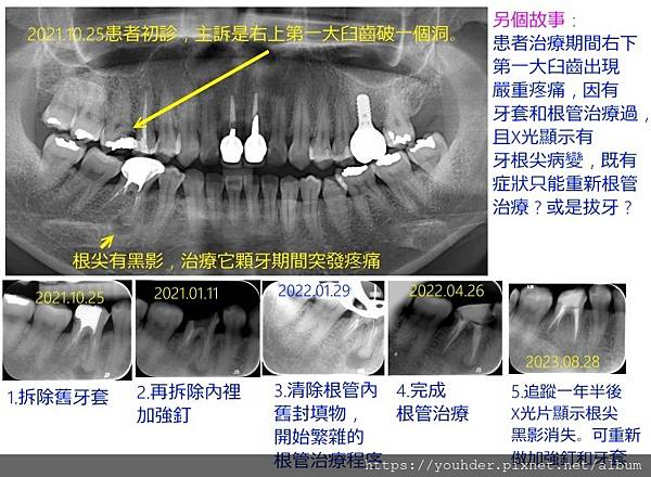 另個故事.jpg