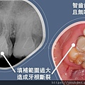 圖片1〈自體移植〉.jpg