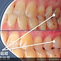 圖片4〈自體移植〉.jpg