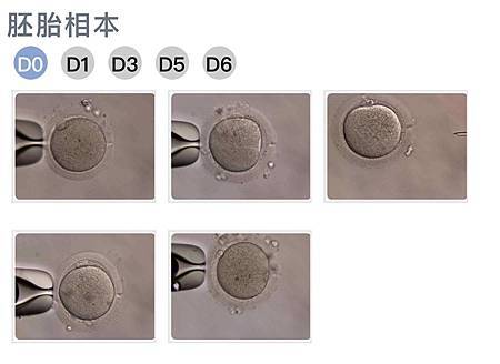 [心得] 送子鳥第二次胚胎培養/PGS/各種療癒