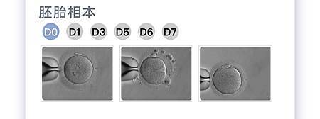 [心得] 送子鳥第三次胚胎培育與PGS