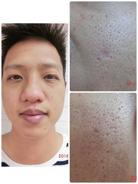 20161212駐顏前.jpg