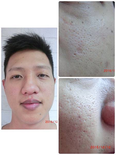 20161212駐顏後.jpg 20161212駐顏後.jpg