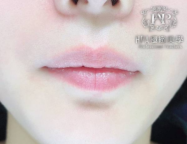 1202HPA-紋唇照片-2.jpg