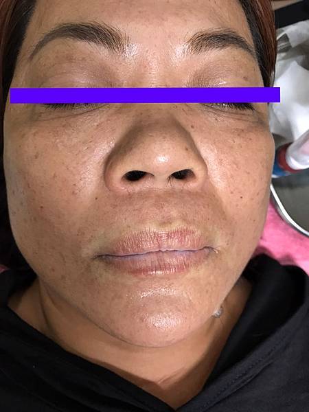 17001-P.jpg 17001-P.jpg