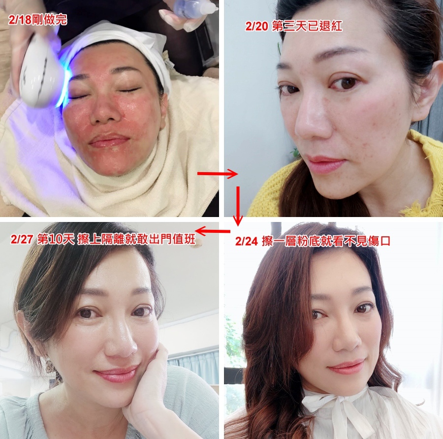 7净妍皮秒.jpg