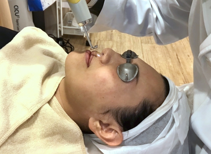 补14净妍皮秒.jpg