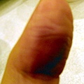 thumb