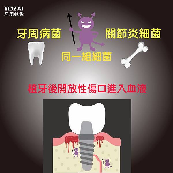 牙周病菌與關節炎細菌同組細菌-01.jpg