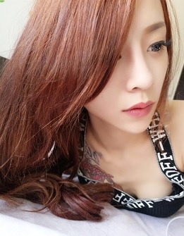 台中玻尿酸蘋果肌0111111.jpg