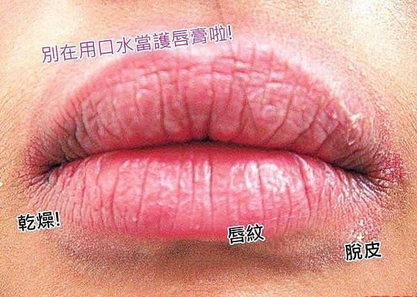 嘴唇乾燥脫皮的救星 蜂膠蜂蠟萬用唇蜜 元昱嚴選的官方部落格 痞客邦