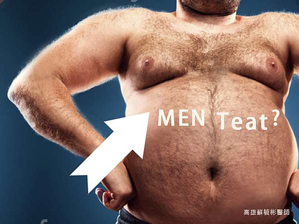 女乳症手術 改善男生又尖又凸的胸部 減少並消除胸部脂肪 復原成平坦胸膛 高雄蘇毓彬醫師 蘇毓彬 整形外科專科醫師 痞客邦 女乳症手術 改善男生又尖又凸的胸部 減少並消除胸部脂肪 復原成平坦胸膛 高雄蘇毓彬醫師 蘇毓彬 整形外科專科醫師 痞客邦