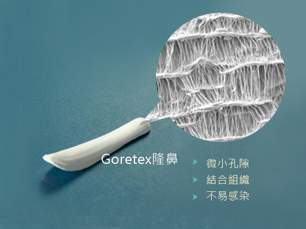 【高雄隆鼻】蘇毓彬醫師：推薦Goretex隆鼻，價格較高但有效減少感染發炎的可能｜高雄蘇毓彬醫師.jpg