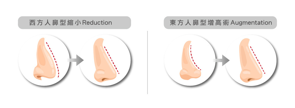 東西方隆鼻-03.jpg