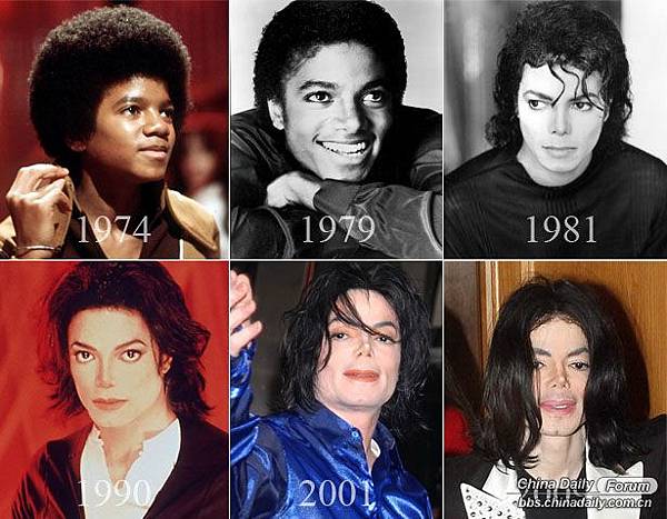 Michael Jackson_麥可傑克森_隆鼻 Michael Jackson_麥可傑克森_隆鼻