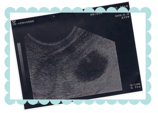 ultrasound55.jpg