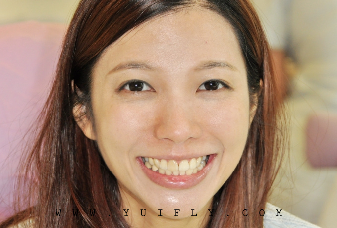 悅庭牙醫_11.jpg 悅庭牙醫_11.jpg