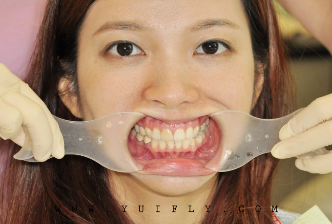 悅庭牙醫_15.jpg 悅庭牙醫_15.jpg