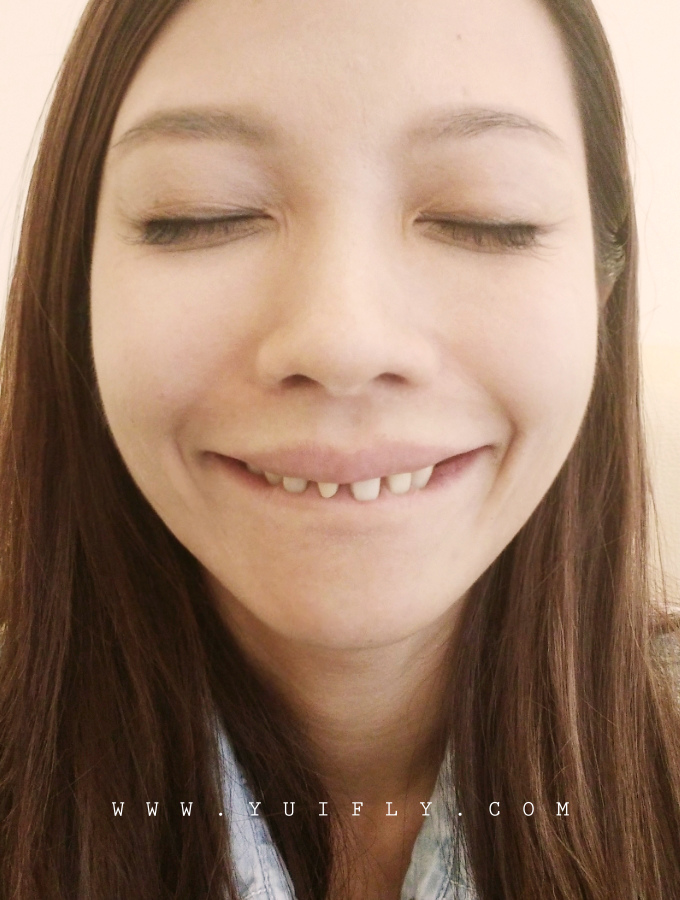 悅庭牙醫_18.jpg 悅庭牙醫_18.jpg